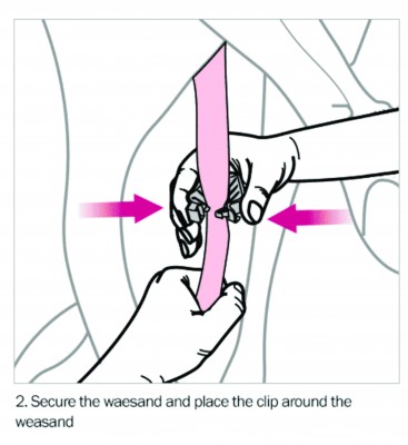 METAL DETECTABLE BEEF WEASAND CLIP